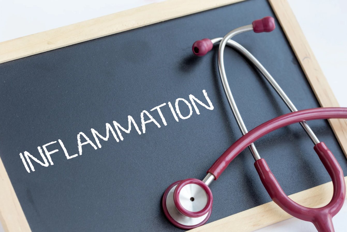 Anti-Inflammatory - Coal Harbour Pharmacy