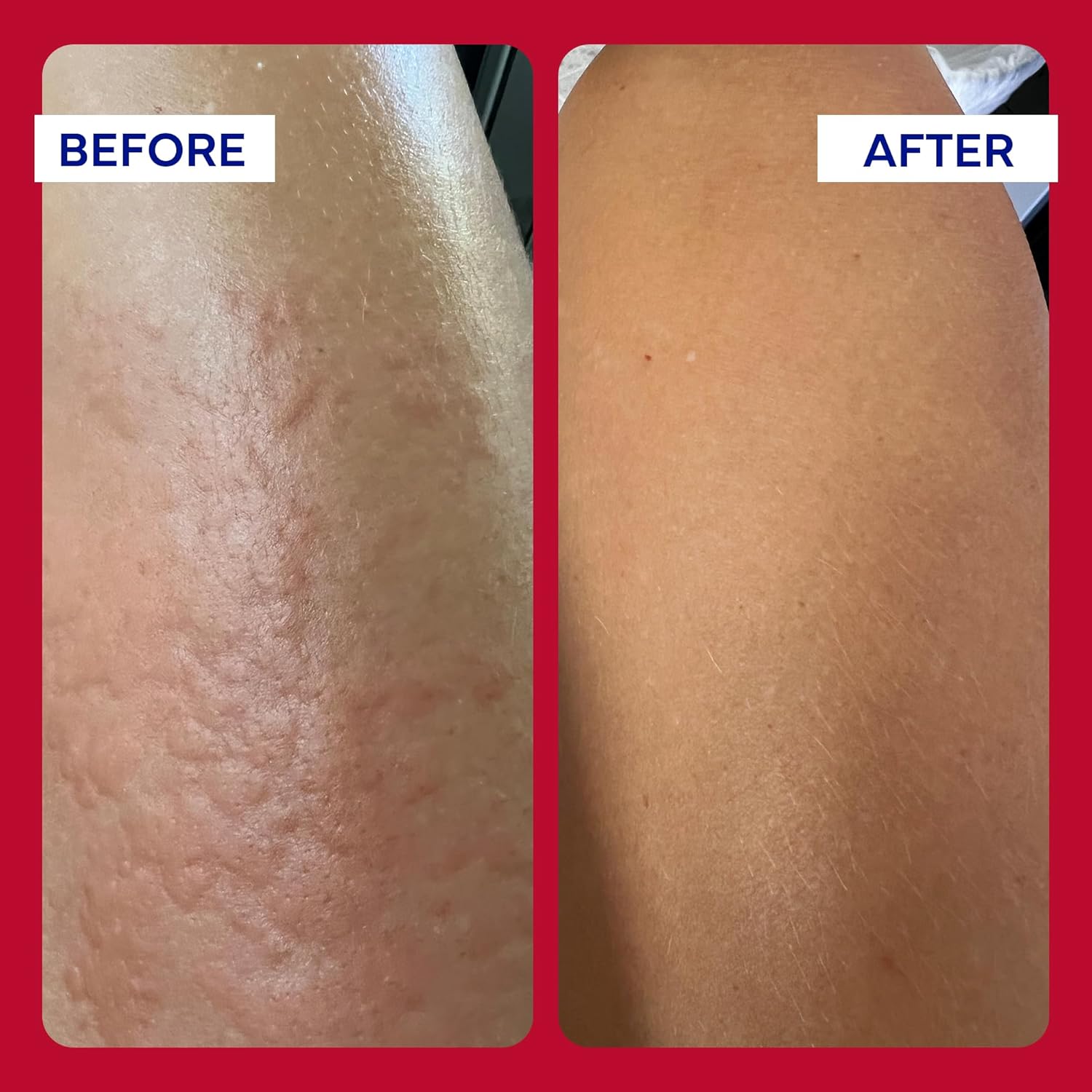 EMUAIDMAX Ointment for Itchy Skin | emuaid® | 59 mL