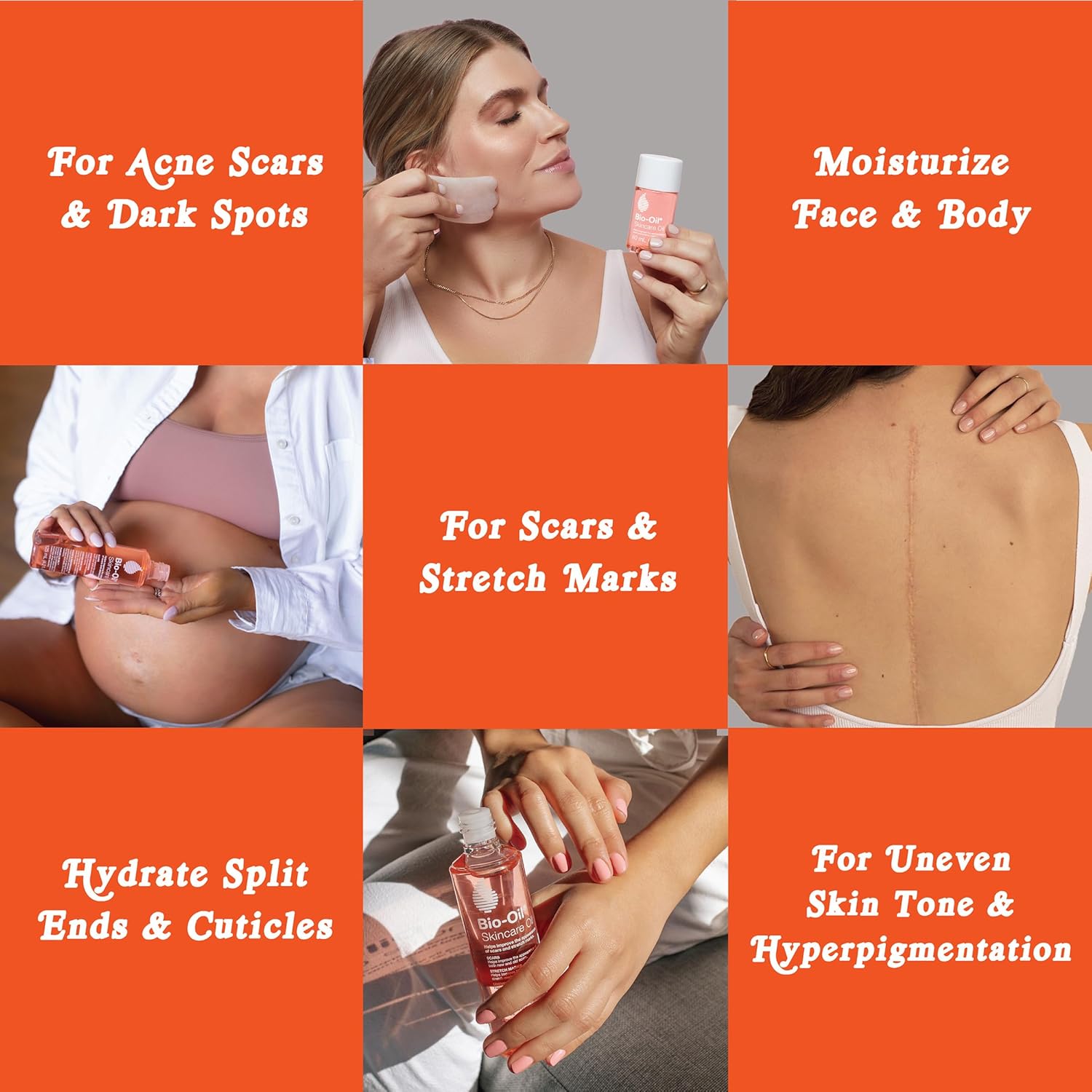 Skincare Oil by Bio-Oil® – Scars, Stretch Marks & Hydration Support | Various Sizes
