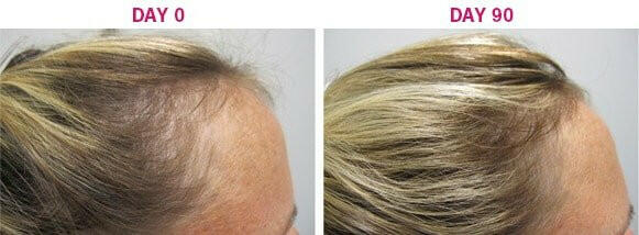 Advanced Hair Health | Viviscal™ | 60 Tablets - Coal Harbour Pharmacy