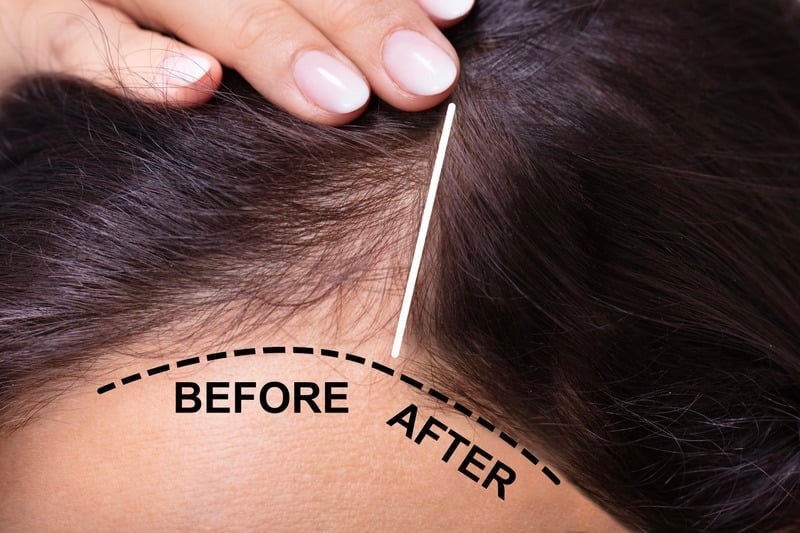 Hair Treatment
