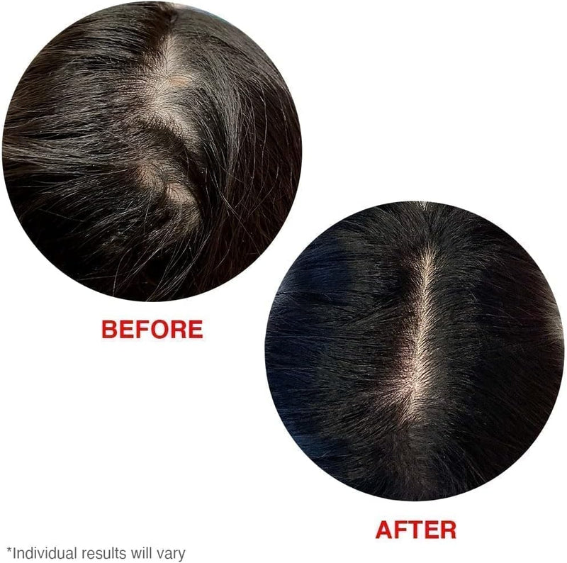 Gorgeous Growth | HAIRtamin® |  60mL Tube