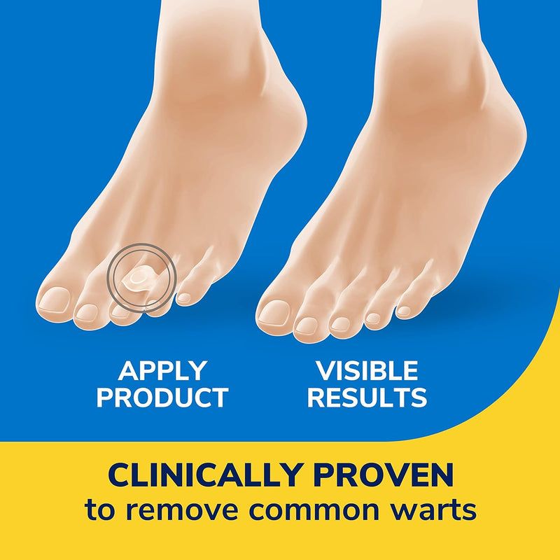 ClearAway Wart Remover | Dr. Scholl's® | 9 cushions Pads/ 12 medicated discs