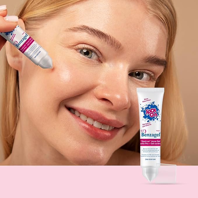 Spot-On Gel by Benzagel | Targeted Acne Treatment | Coal Harbour