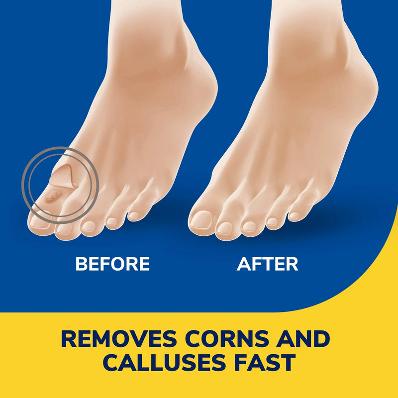 Liquid Corn & Callus Remover | Dr. Scholl's® | 3 Cushions