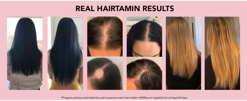 Advanced Formula Vitamins | HAIRtamin® | 30 Capsules