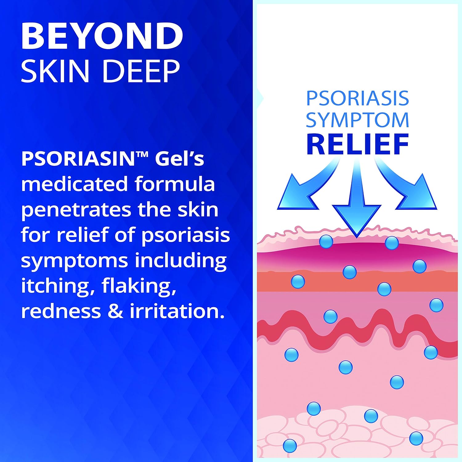 Psoriasis Relief Gel|Psoriasin |21.25g
