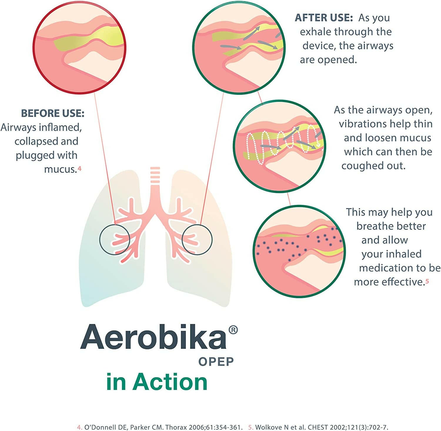 Oscillating Positive Expiratory Pressure (OPEP) Device | Aerobika® | 1 OPEP Device - Coal Harbour Pharmacy